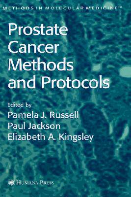 【预售】Prostate Cancer: Methods and Protocols