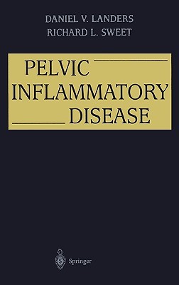 【预售】Pelvic Inflammatory Disease