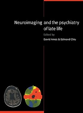 【预售】Neuroimaging and the Psychiatry of Late Life