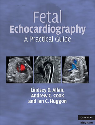 【预售】Fetal Echocardiography: A Practical Guide [With