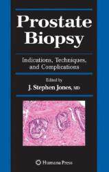 【预售】Prostate Biopsy: Indications, Techniques, and