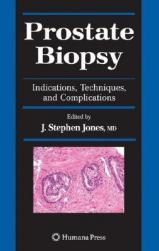 【预售】Prostate Biopsy: Indications, Techniques, and