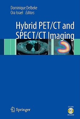 【预售】Hybrid PET/CT and SPECT/CT Imaging: A Teaching File