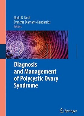 【预售】Diagnosis and Management of Polycystic Ovary