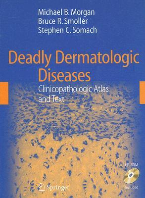 【预订】Deadly Dermatologic Diseases: Clinicopathologic