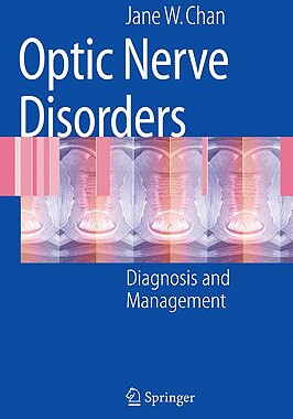 【预售】Optic Nerve Disorders: Diagnosis and Management
