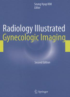 【预售】Radiology Illustrated: Gynecologic Imaging