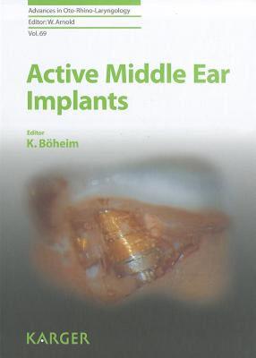 【预售】Active Middle Ear Implants
