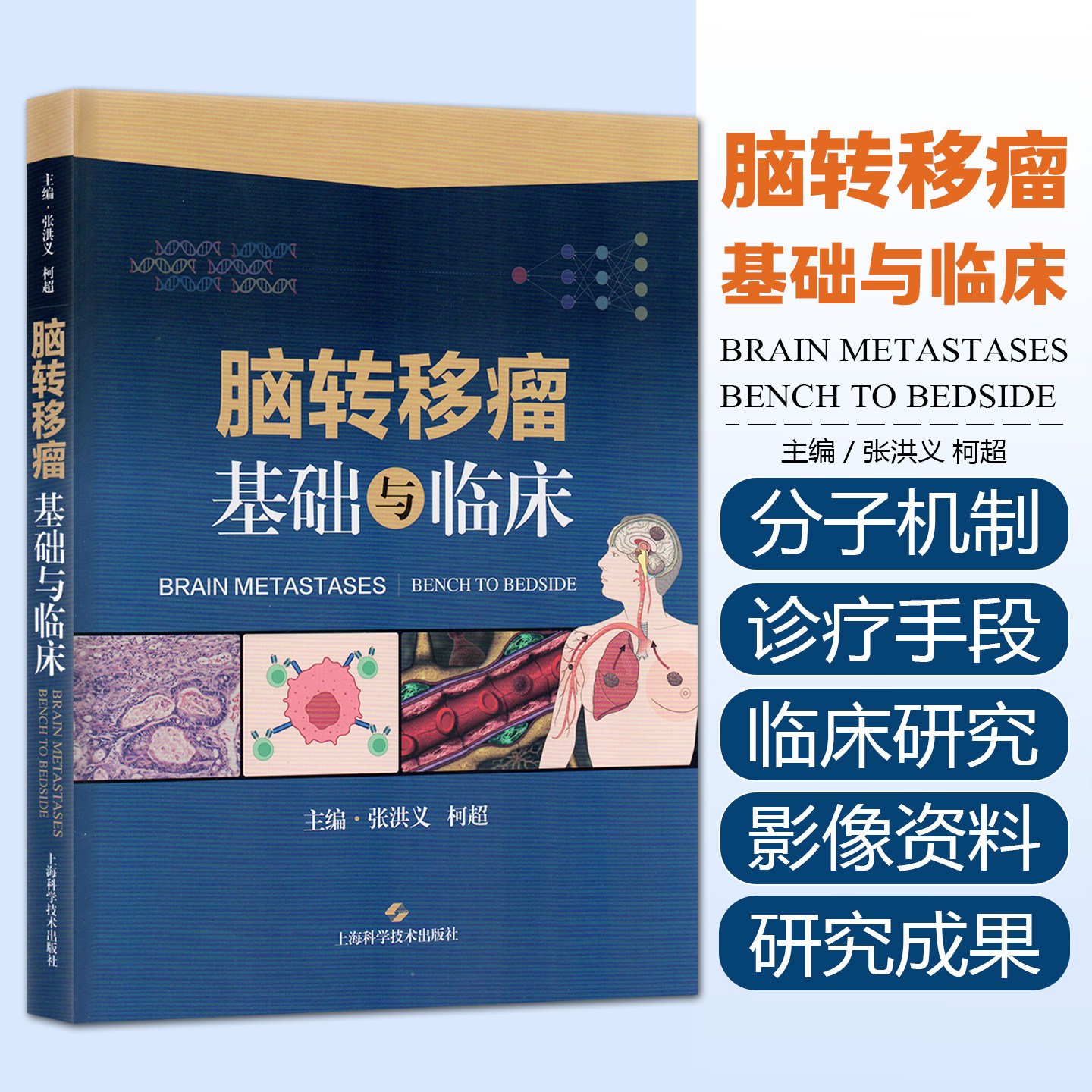 脑转移瘤基础与临床肿瘤科