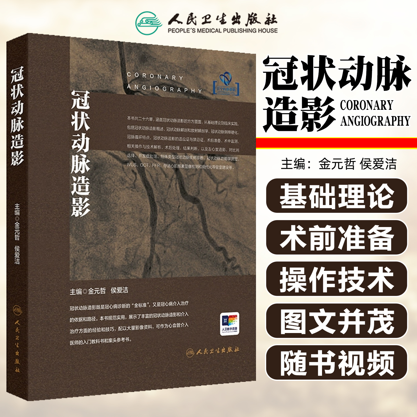 冠状动脉造影（配增值）