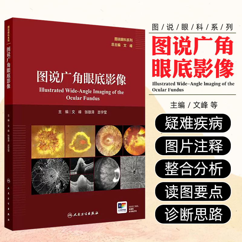 正版 图说广角眼底影像 广角眼底影像在眼底病诊疗中的应用 特色图片点评突出广角影像技术在各类眼底病中的优势 人民卫生出版社