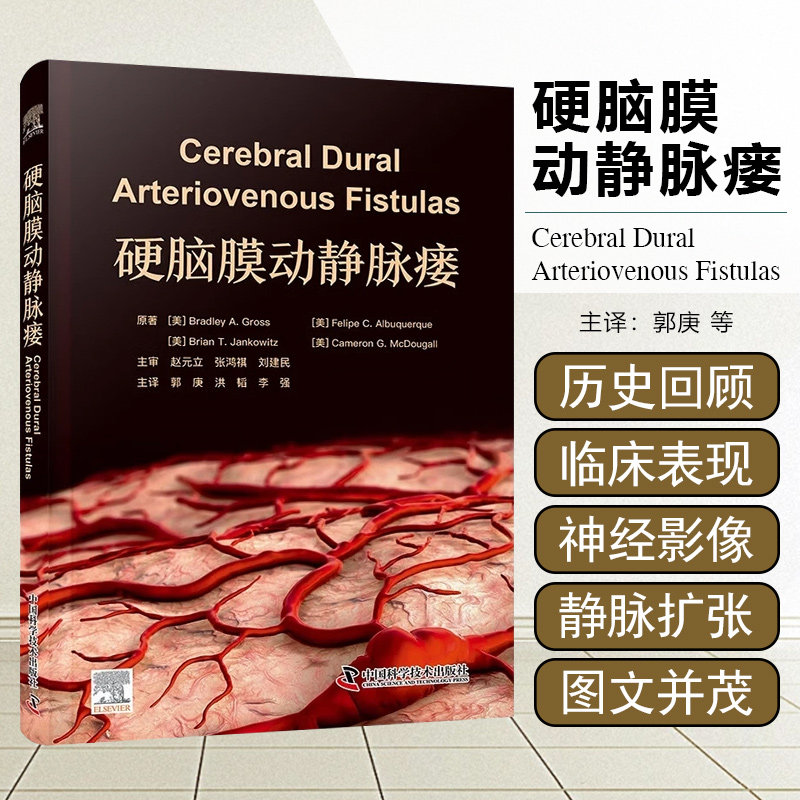 硬脑膜动静脉瘘 中国科学技术出版社9787523604724