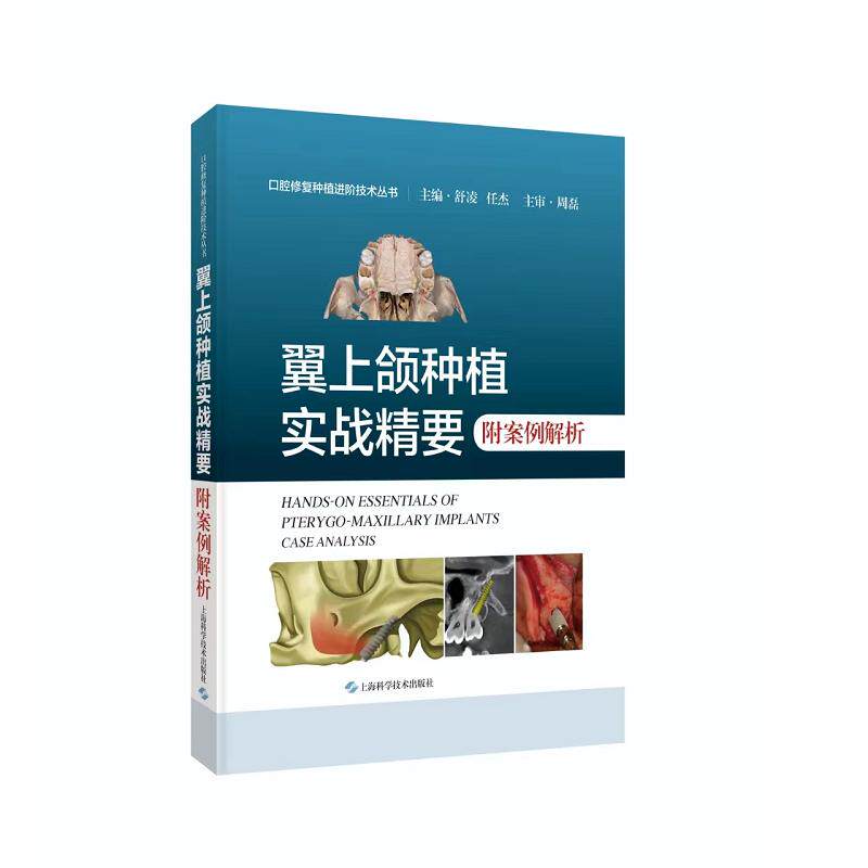 翼上颌种植实战精要:附案例解析 上海科学技术出版社9787547865705