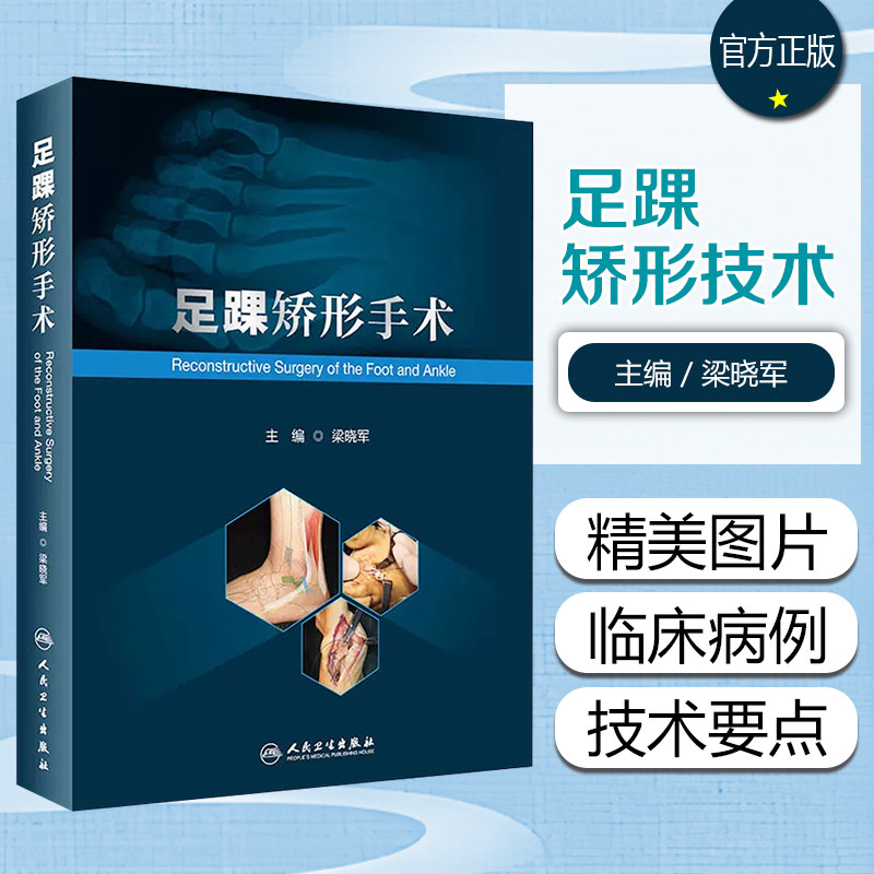 正版 足踝矫形手术 帮助读者对足踝畸形相关知识体系构建手术方式进行选择 梁晓军主编 人民卫生出版社9787117332699