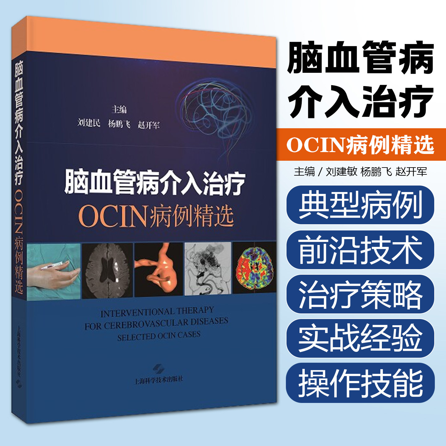 脑血管病介入治疗OCIN病例精选刘建民杨鹏飞赵开军上海科学技术出版社9787547873052