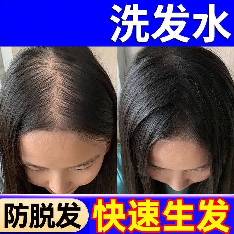 哥歌瑞殴洗发水防脱发生发控油蓬松去屑止痒侧柏叶官方店正品