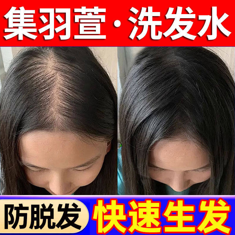 集羽萱洗发水防脱发蓬松控油生髪变黑发去屑止痒增密官方店
