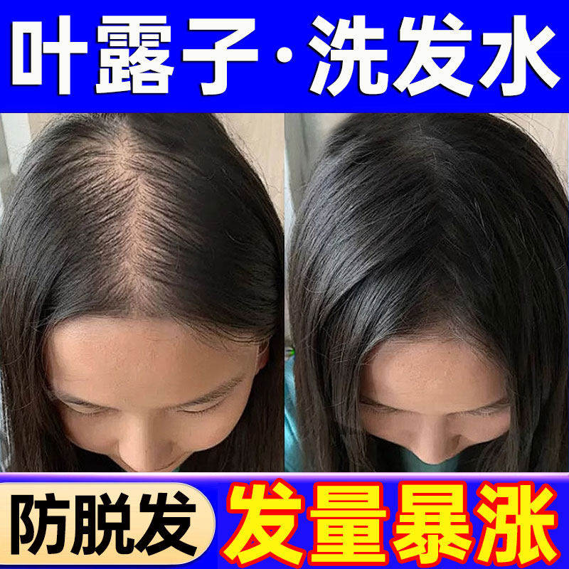 叶露子洗发水防脱健发生发控油蓬松去屑侧柏叶路子正品官方店