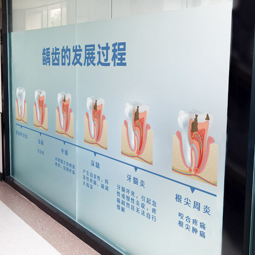 牙科诊所根管治疗磨砂静电膜
