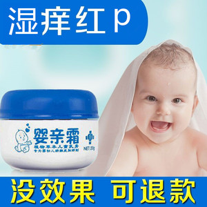 正品旗舰店老配方婴亲霜正品零激素宝宝尿布红湿痒膏口水婴儿面霜