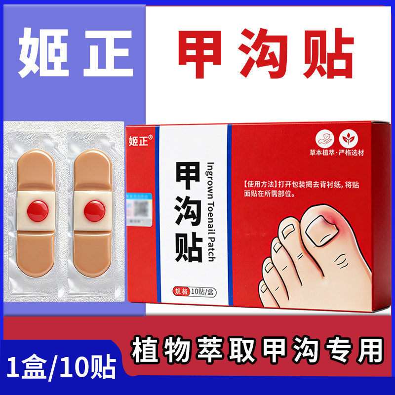 姬正甲沟贴矫正器正甲贴嵌甲脚指甲纠正器防趾甲长肉里专用隔离贴