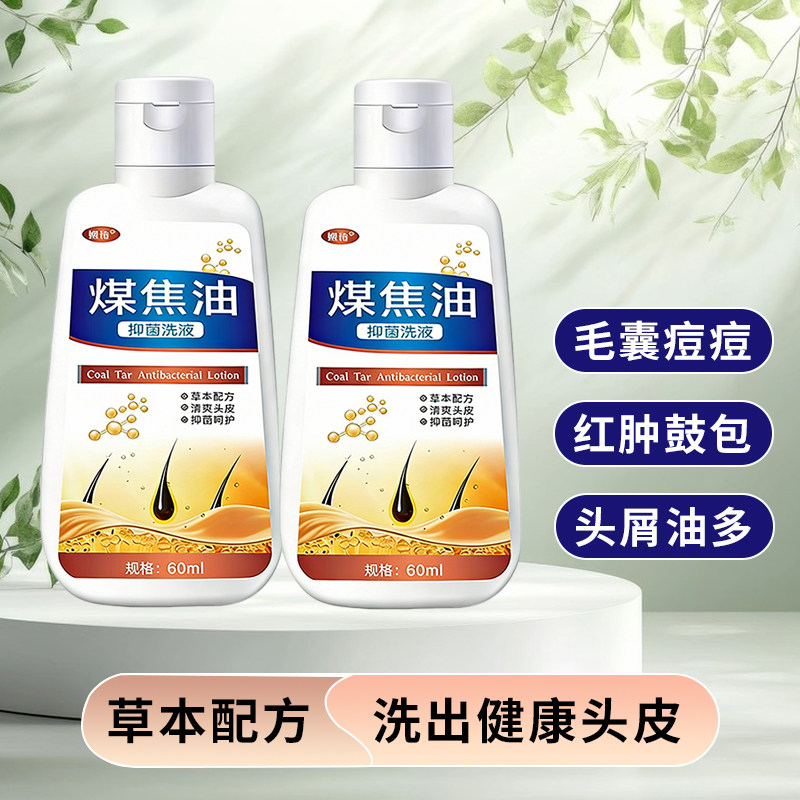 煤焦油洗液官方正品头痒脂溢性去头油头屑草本洗剂水洗发