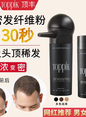 toppik头发纤维粉增发神器密发发际线填充补发稀少发量增多喷雾男