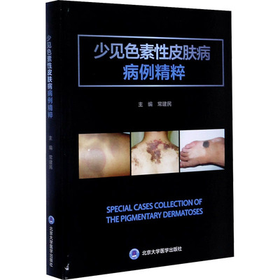 少见色素性皮肤病病例精粹 北京大学医学出版社 常建民 编 皮肤病学/性病学
