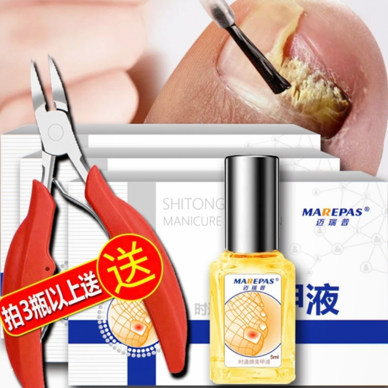 美甲液指甲专用护理套装灰甲水脚趾手护理变厚竖纹护甲油修复液