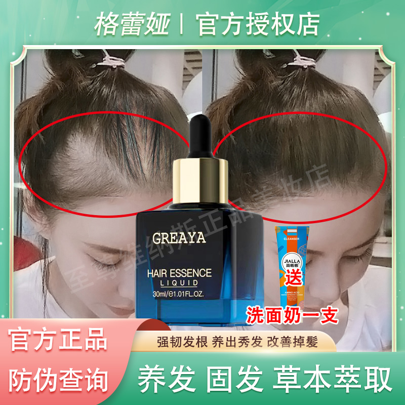 格蕾娅GREAYA精华液生发液育发液