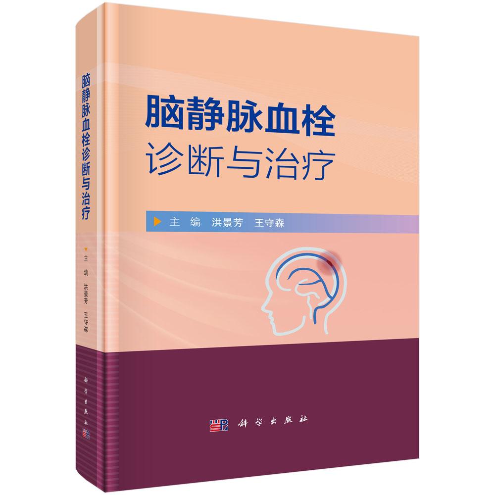 脑静脉血栓诊断与治疗