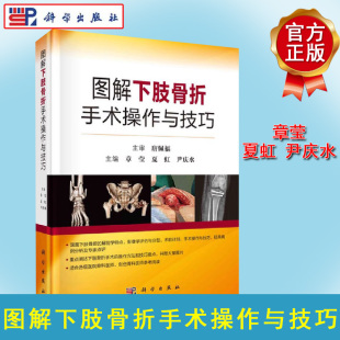 科学出版 图解下肢骨折手术操作与技巧 尹庆水 夏虹 社股骨头骨折与脱位股骨颈股骨转子间股骨干技巧要点外科学 章莹