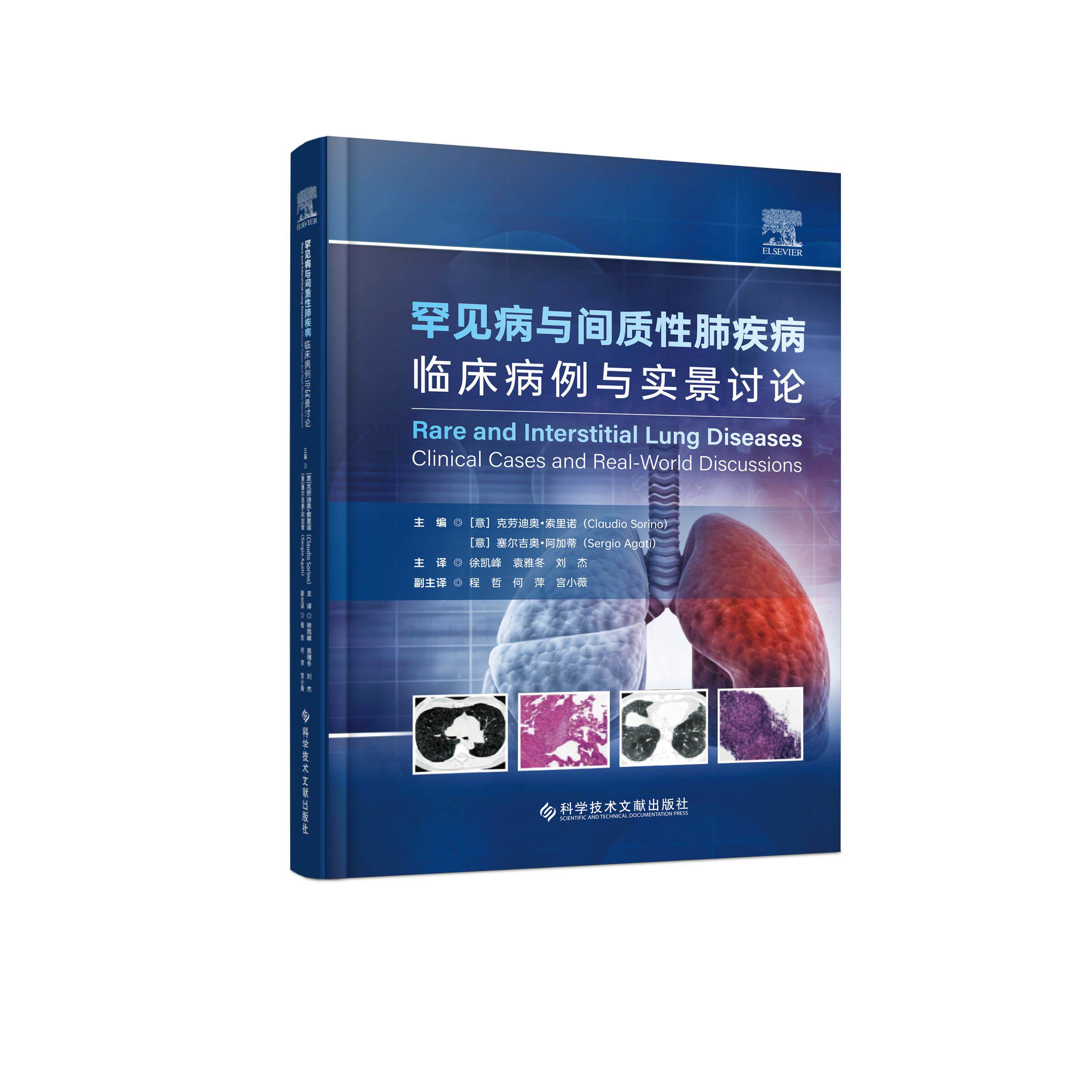 罕见病与间质性肺疾病临床病例与实景讨论 徐凯峰 袁雅冬 刘杰主译 9787523538845 科学技术文献出版社