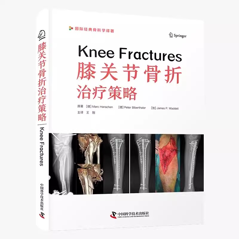膝关节骨折治疗策略 王刚 译者 中国科学技术出版社9787523606193