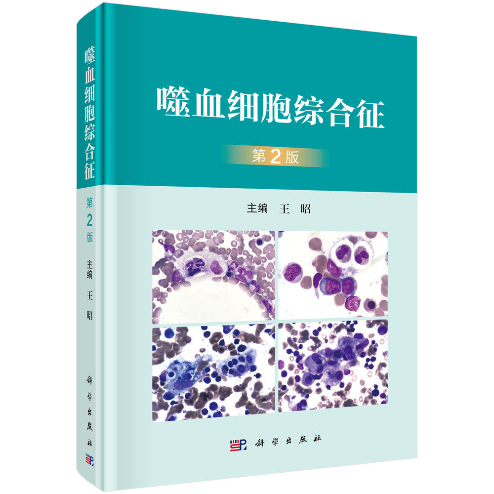 噬血细胞综合征（第2版）王昭 噬血细胞综合征发病现状诊断及治疗原发性噬血细胞综合征感染相关噬血细胞肿瘤巨噬细胞活化综合征