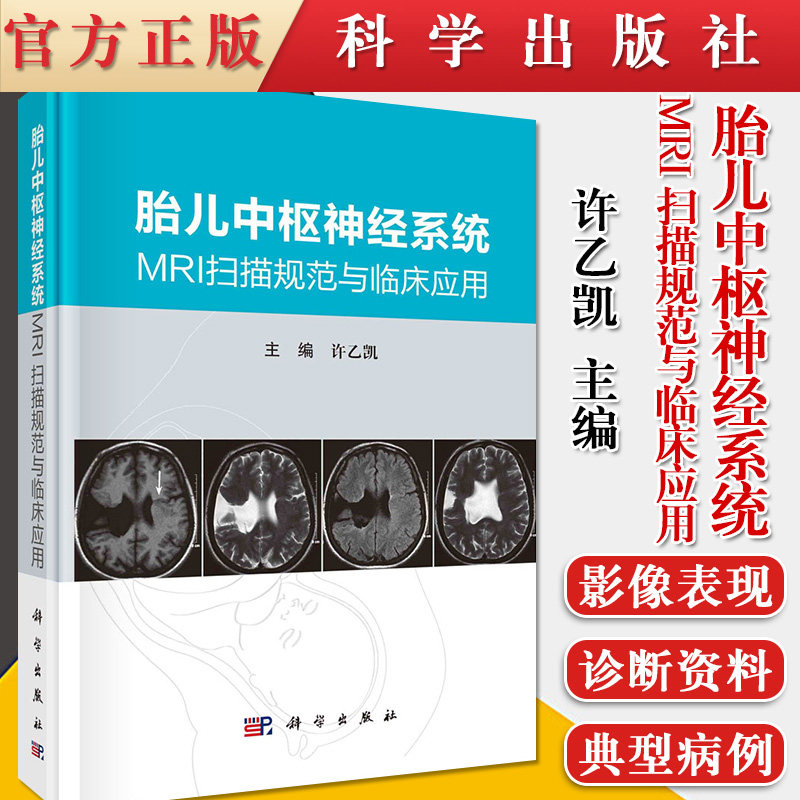 胎儿中枢神经系统MRI扫描规范与临床应用 科学出版社9787030684813