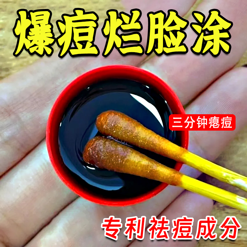 【热爆推荐】祛痘净颜喷雾青春期 冒痘油脂旺盛消痘淡印