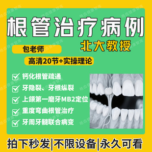 口腔根管治疗视频教程 根管治疗高级病例教程 弯曲根管 钙化根管