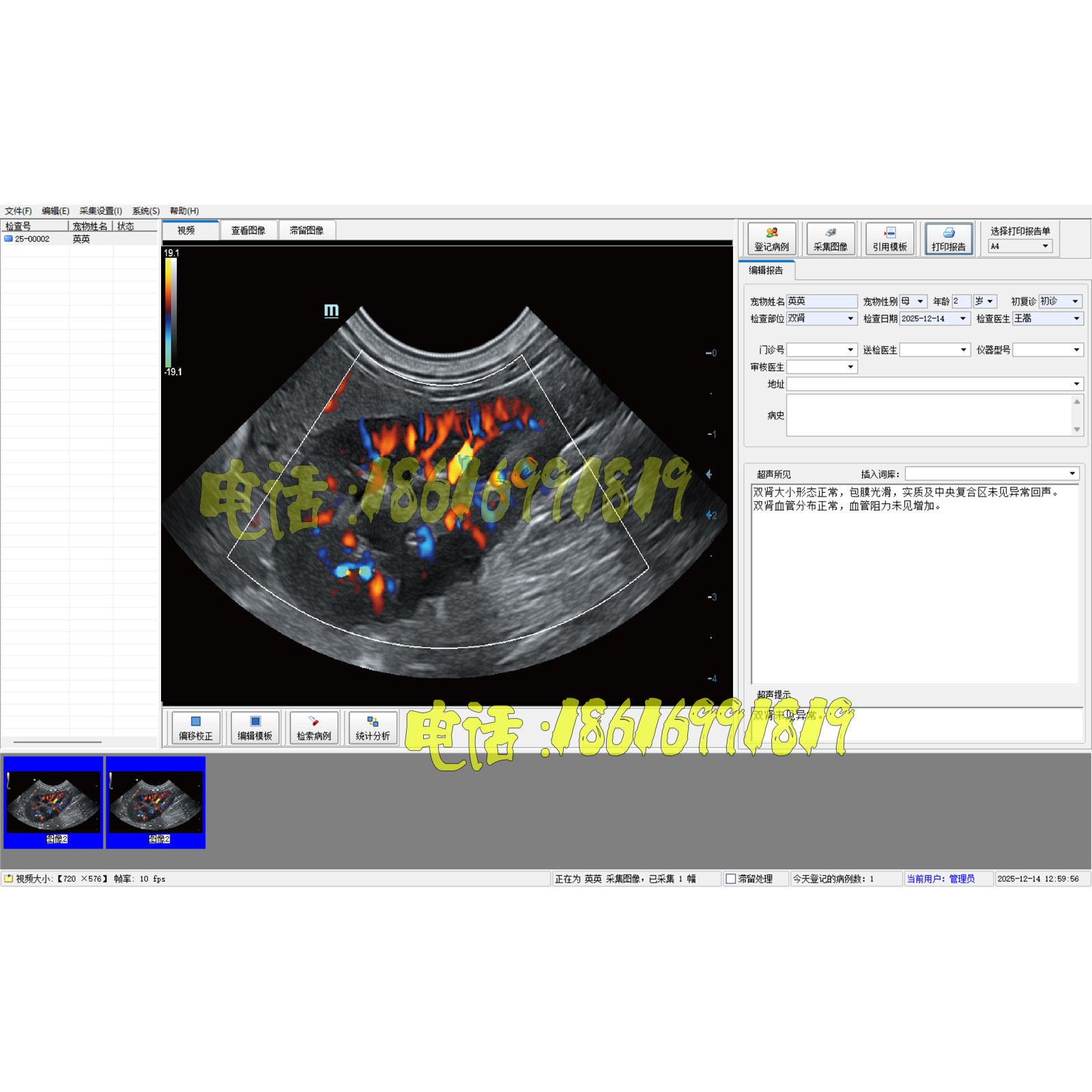 宠物超声工作站宠物版超声软件宠物B超软件宠物彩超软件全套包邮