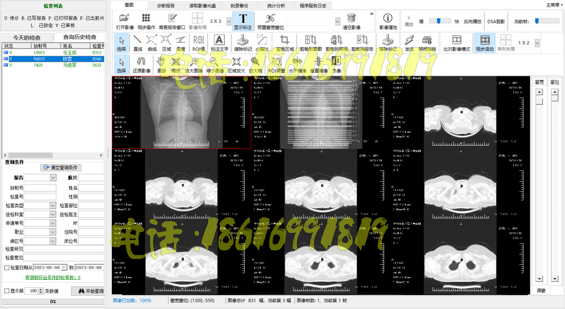 CT软件CT工作站X光机软件DR软件CR软件MRI软件DSA软件PACS系统