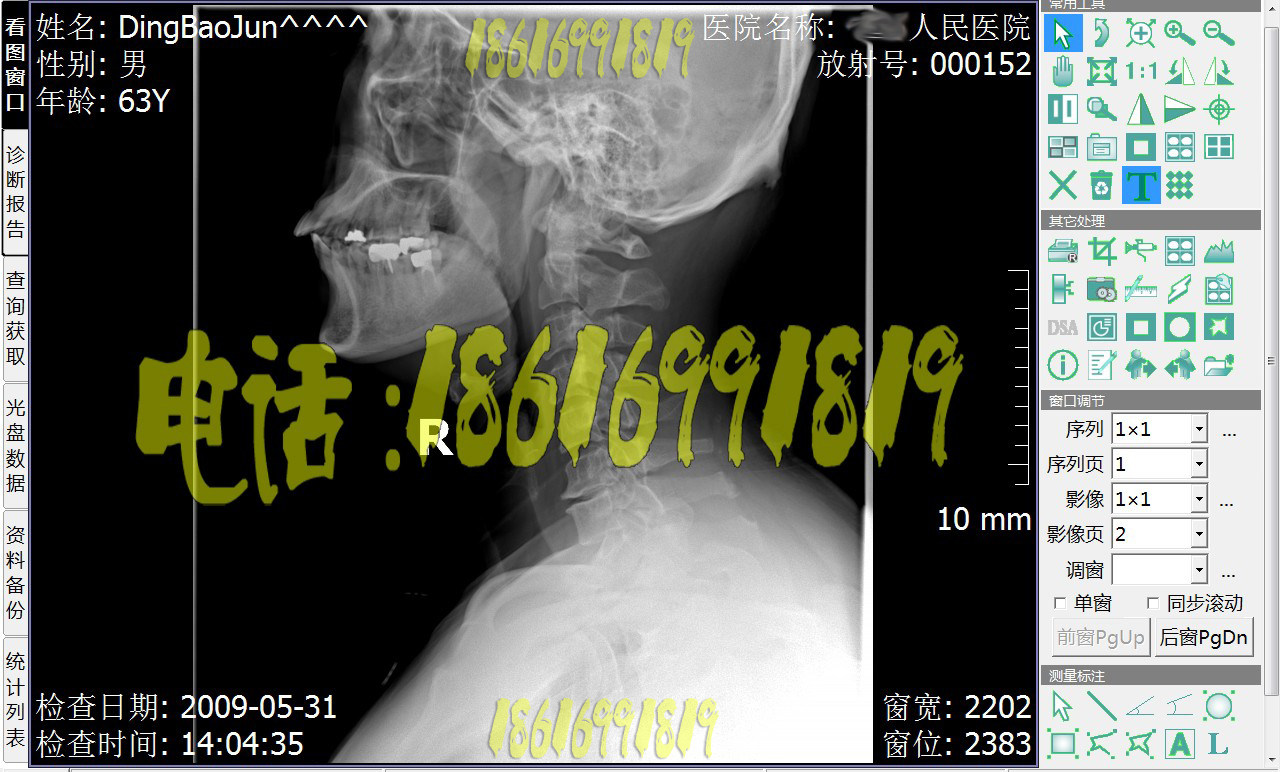 DR软件DR工作站软件CR软件CT工作站软件放射科pacs软件