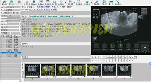 超声软件彩超软件迈瑞超声