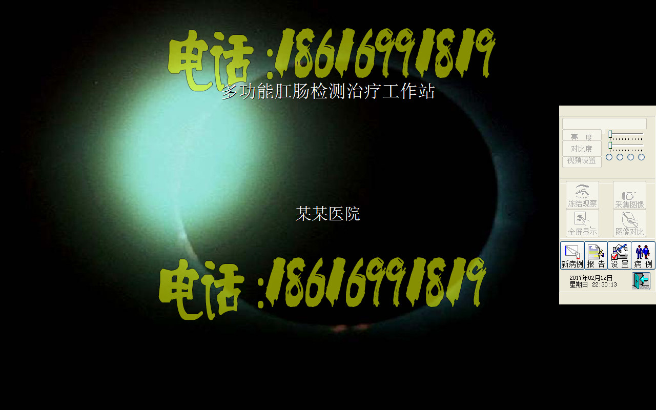 肛肠镜软件肛肠镜检查系统肛肠镜随心所欲xp/win7/win10版加密锁