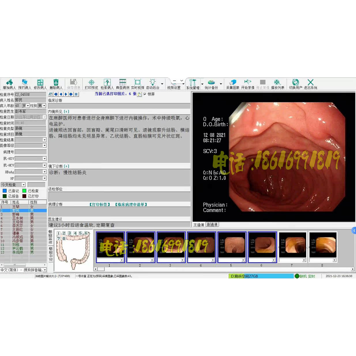 胃镜软件肠镜耳鼻喉镜软件胃肠镜工作站软件胃镜工作站内窥镜软件,3C数码配件,其它配件,淘宝优惠券,粉丝福利购,淘宝优惠卷