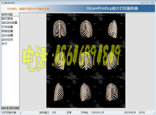 Dicom模拟激光相机PrintScp胶片打印服务器喷墨胶片打印软件6.0