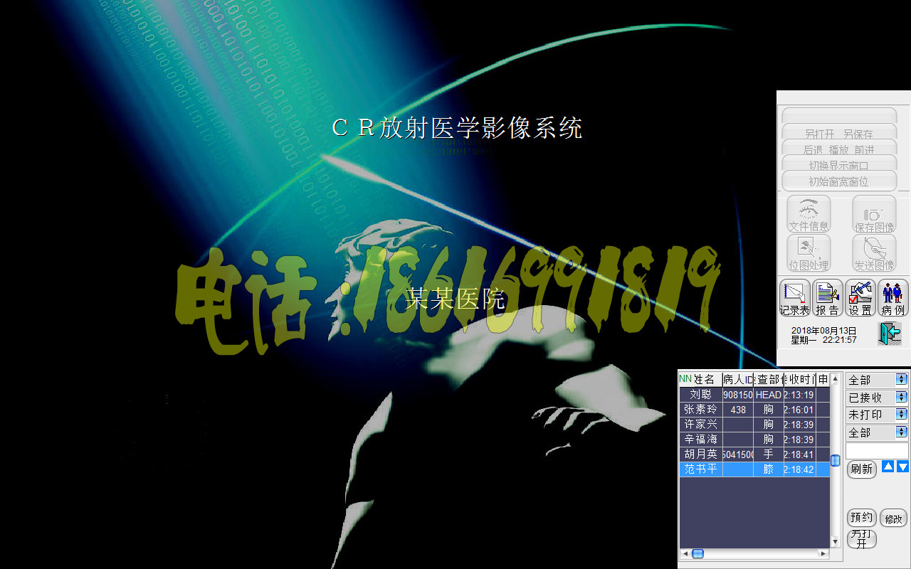 CR工作站软件CR软件DR工作站软件X光机软件数字胃肠机工作站软件