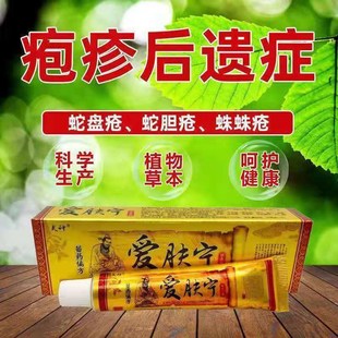 买2送1 3送2夫神爱肤宁乳膏带状疱疹后遗症神蛇盘疮膏疱疹蛇盘