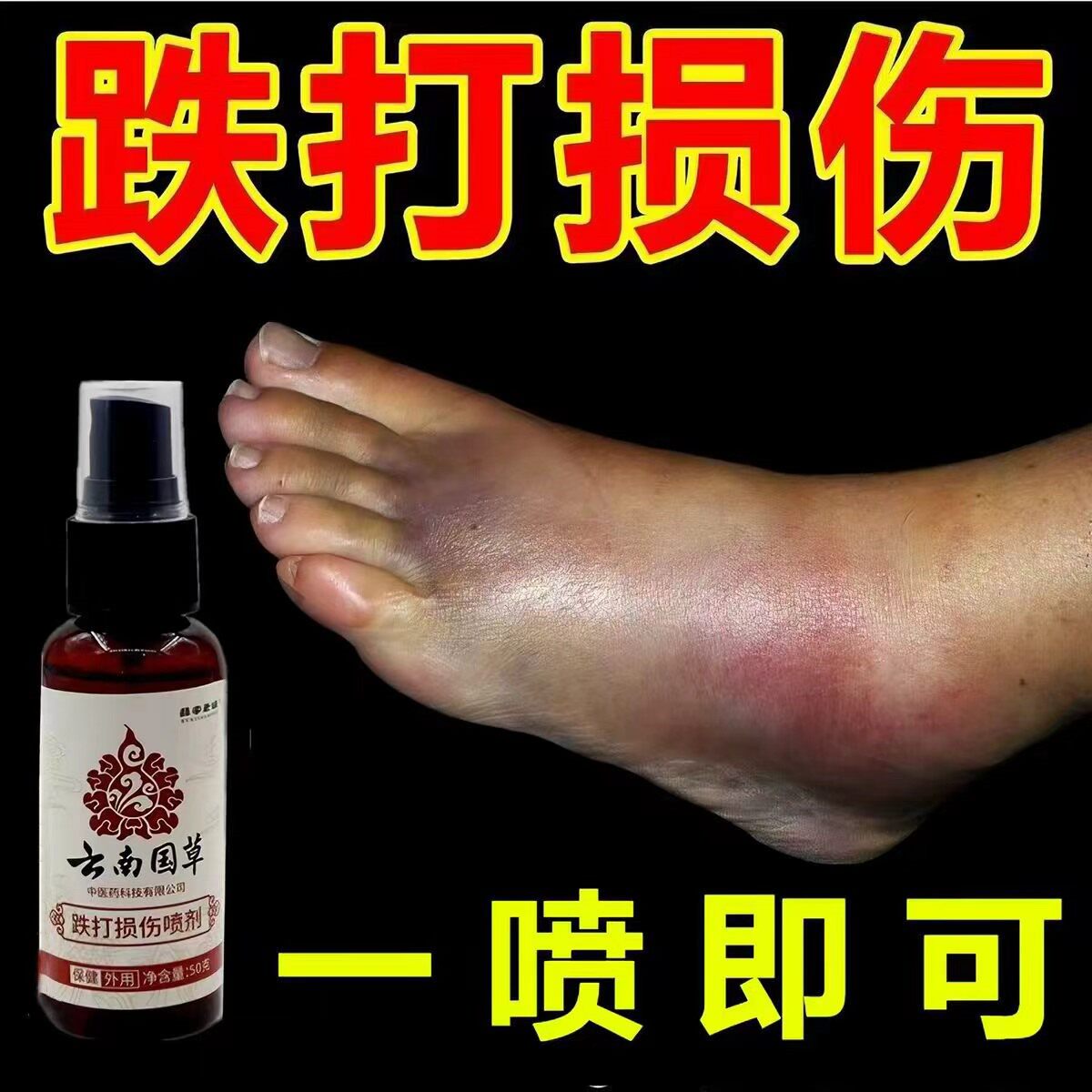 跌打损伤喷剂扭伤肿软组织伤脚踝崴伤骨伤肌肉肿痛韧带拉伤喷雾剂