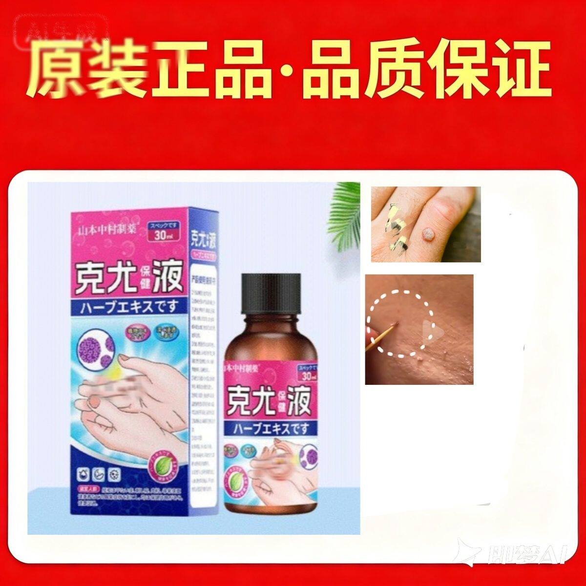 手指上长疙瘩刺瘊子手指肉刺球手足凸起寻常疙瘩粗糙肉钉温和液