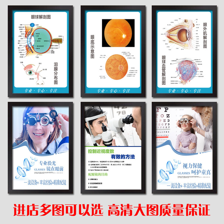眼镜店海报装饰画专业眼科医院墙画近视镜验光配镜宣传画眼球图挂